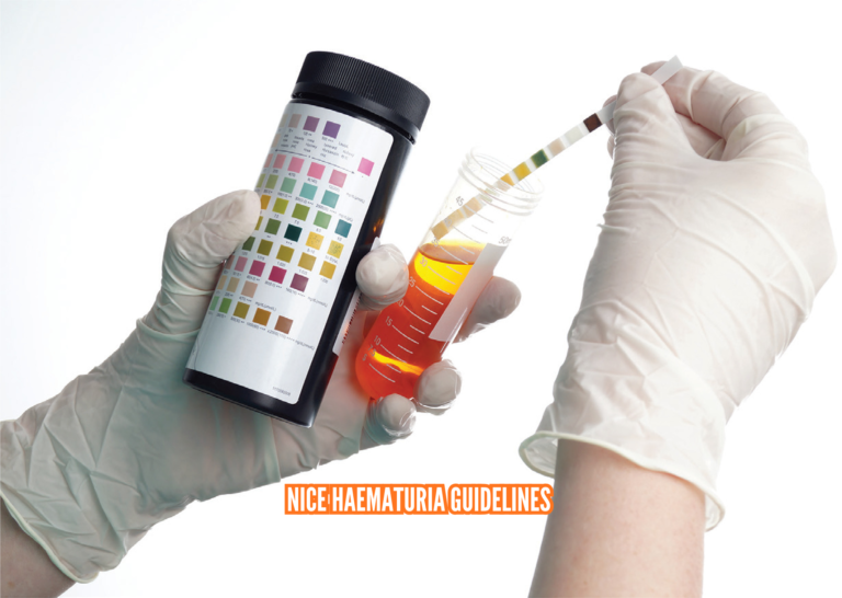 NICE Haematuria Guidelines Age Criteria Referral Process and Medical Advice plandescil ltd
